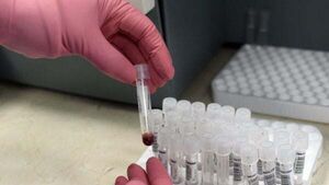 Number of people living with HIV in Ireland increases to 100 cases per month Number of people living with HIV in Ireland increases to 100 cases per month