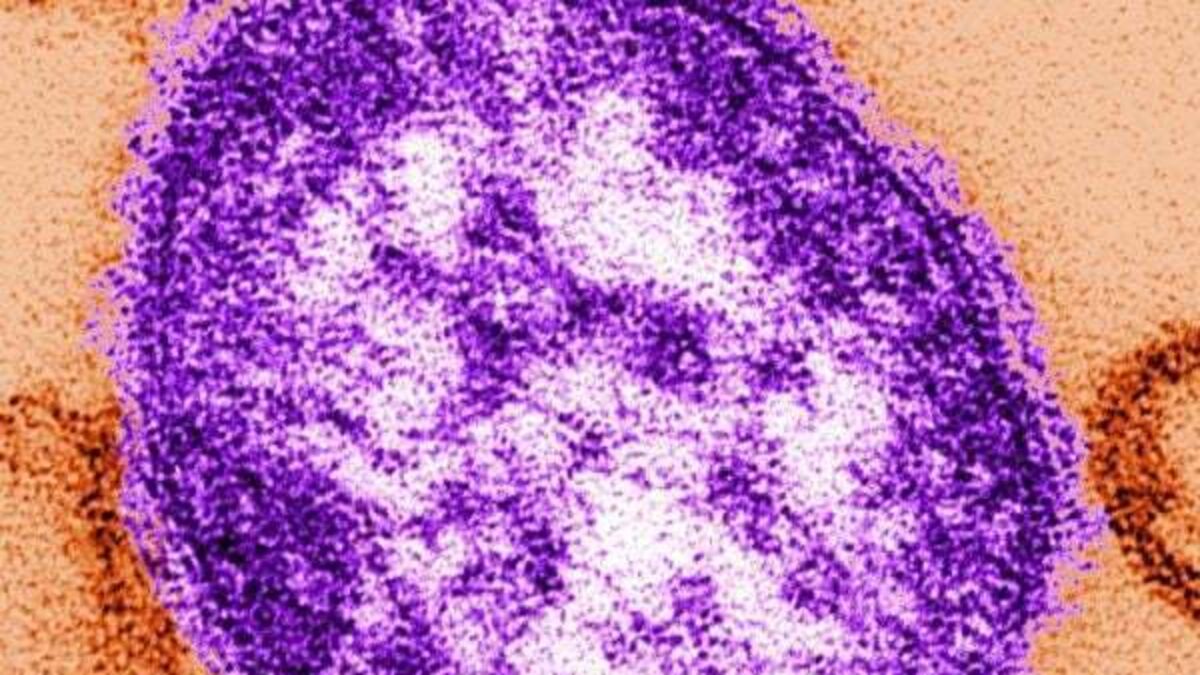 Nine suspected cases of measles in Ireland recorded in one week