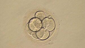 Couple sue fertility clinic over loss of embryos Couple sue fertility clinic over loss of embryos
