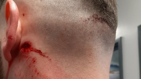 Police officer suffers head injury after masonry thrown during Belfast unrest