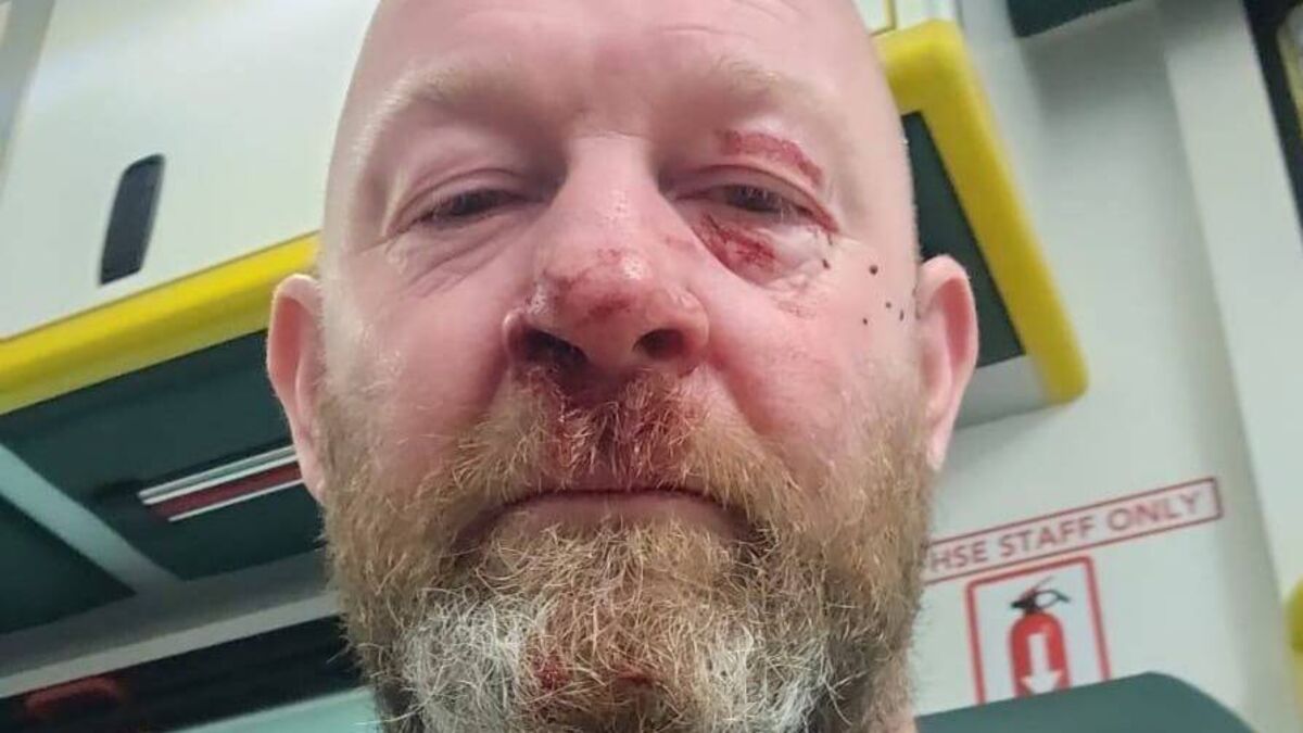 Coach headbutted by parent at U12 game