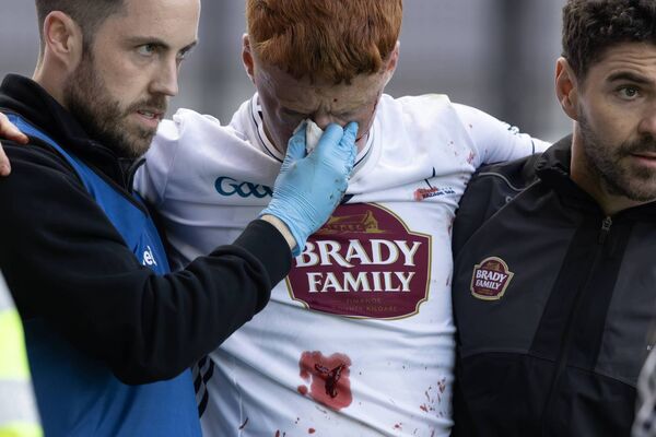 O'Neill is helped from the field after suffering a serious facial injury after bravely making a block against Westmeath in the Leinster Championship in April Photo: Sean Brilly O'Neill is helped from the field after suffering a serious facial injury after bravely making a block against Westmeath in the Leinster Championship in April Photo: Sean Brilly