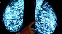 HSE breast cancer screening programme misses targets for past two years
