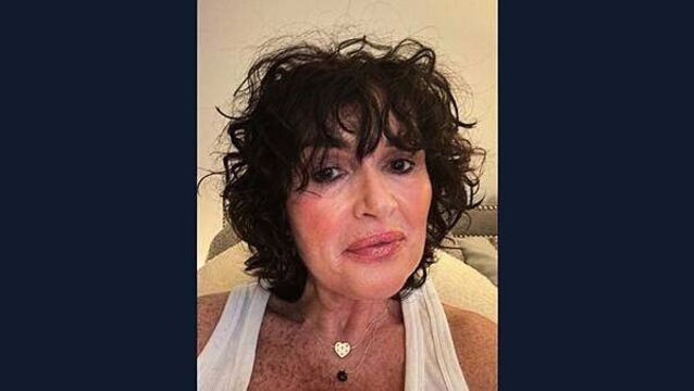 Cancer patient's 'scanxiety' with delay in scan results as HSE admit to needing more radiologists Cancer patient's 'scanxiety' with delay in scan results as HSE admit to needing more radiologists