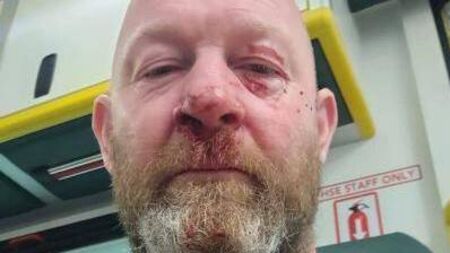 Father headbutted coach after son was substituted in under-12 match
