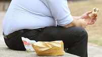 Irish public ‘least likely to blame environmental factors for obesity epidemic’
